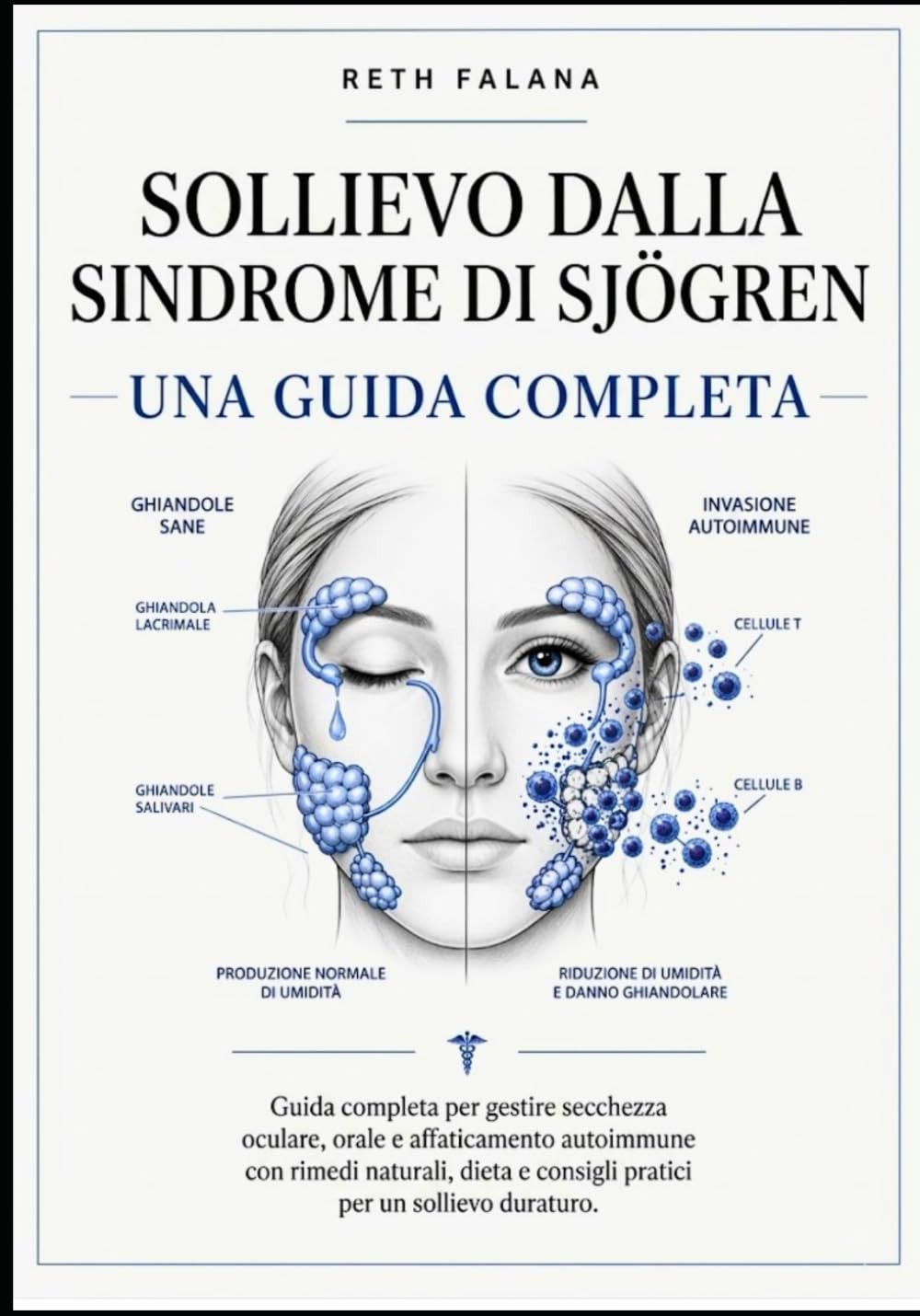 Sollievo dalla sindrome di Sjögren: Guida completa per gestire secchezza oculare, orale e affaticamento autoimmune con rimedi naturali, dieta e consigli pratici per un sollievo duraturo.