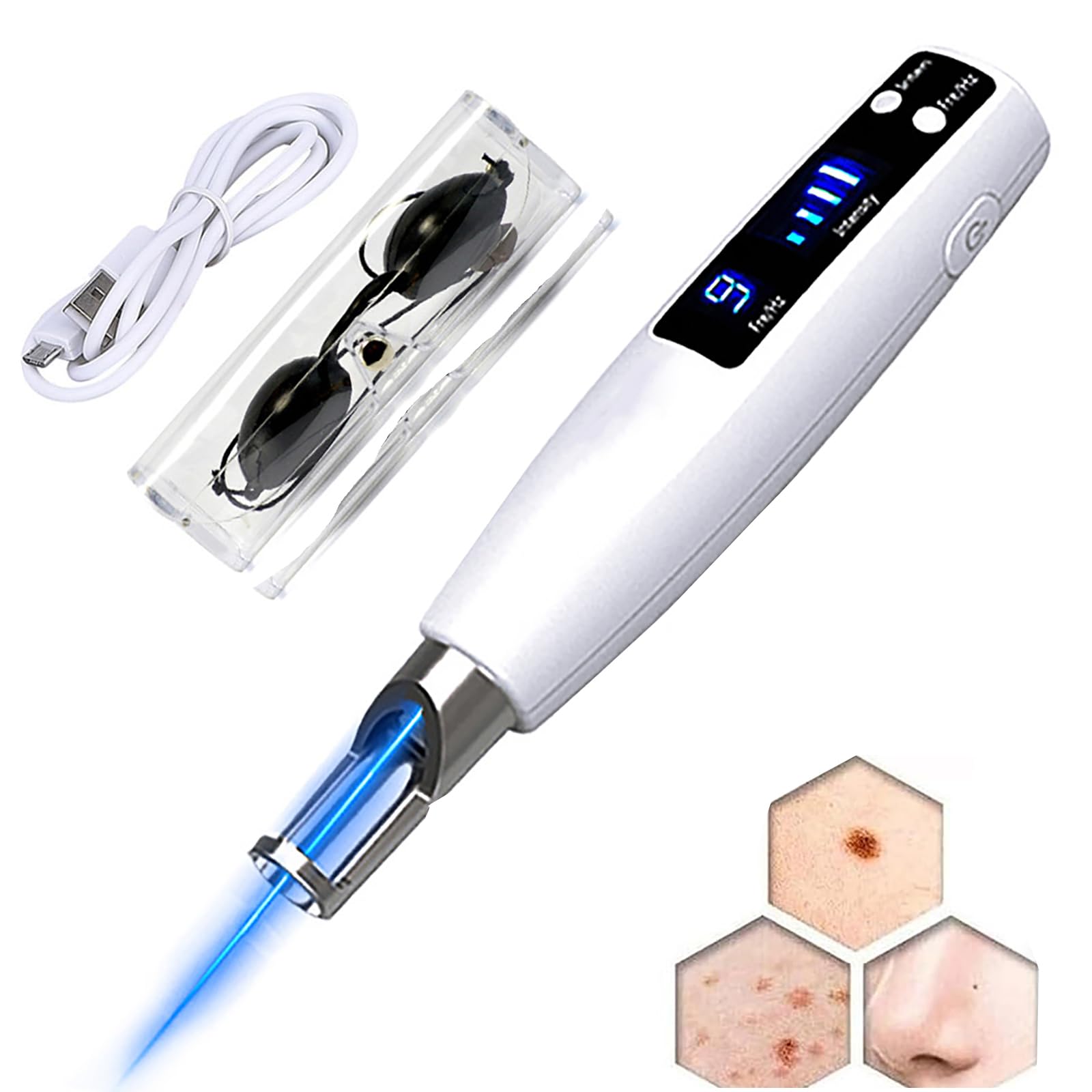 LáPiz De Plasma Profesional para Eliminar Lunares, Dispositivo De Picosegundos con 9 Modos Y 4 Niveles De Intensidad, con Pantalla LCD E IluminacióN, para Verrugas, Pecas, Lunares,Blue