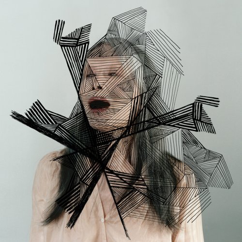Epilepsy Is Dancing