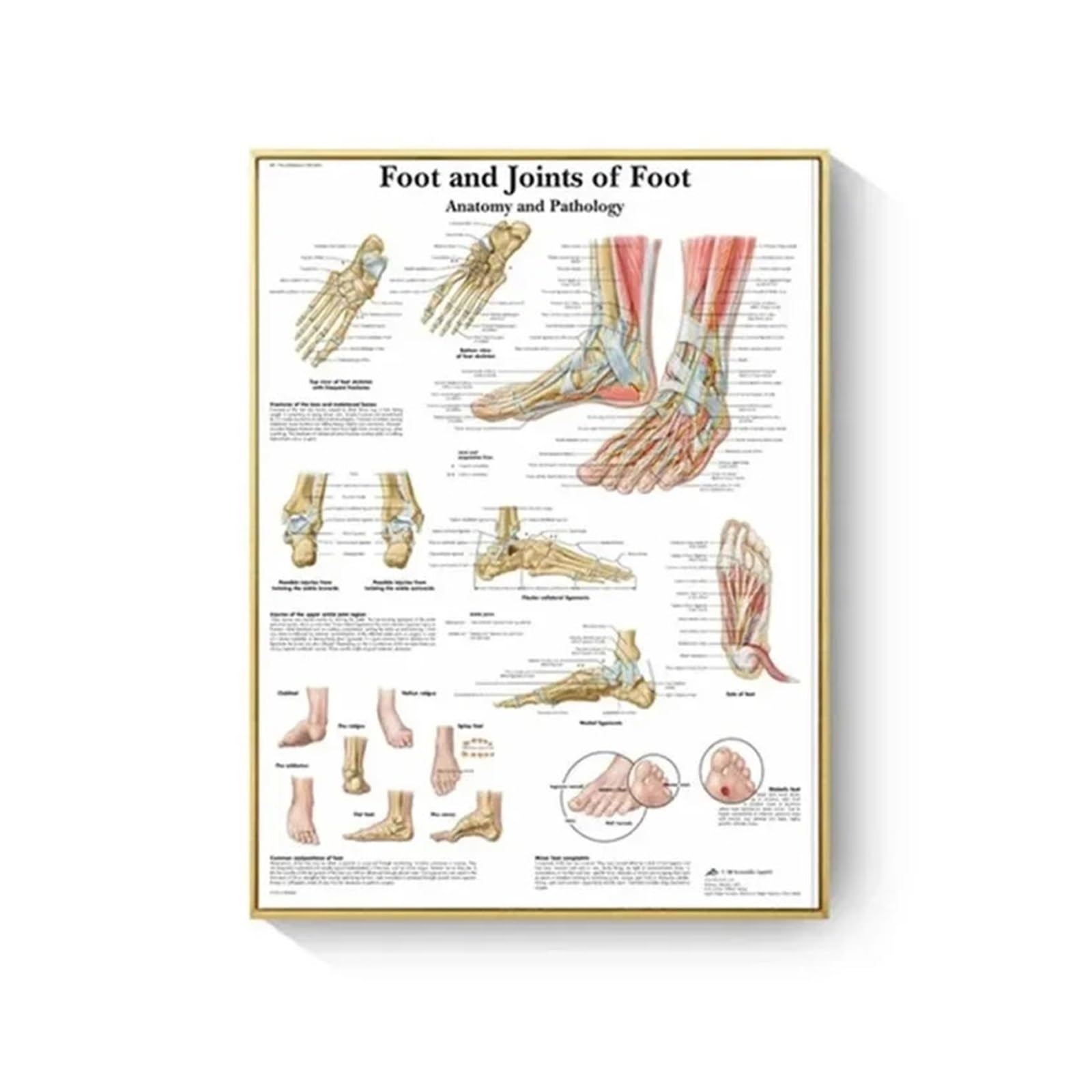 Anatomie humaine système muscles affiche sur toile pour réviser la médecine