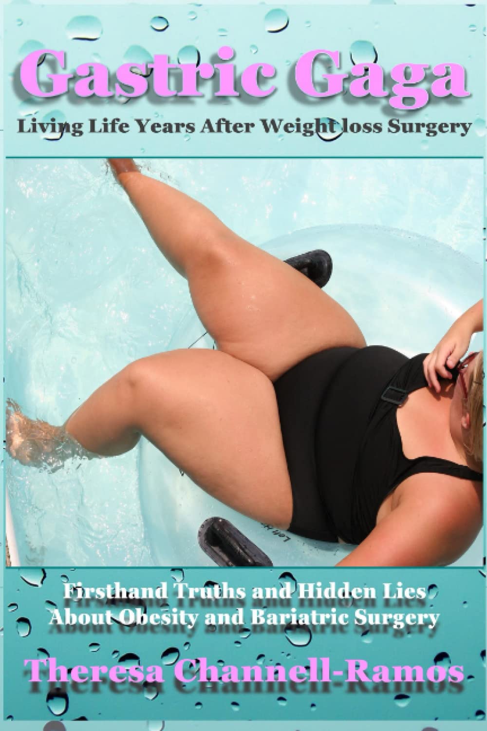 Gastric Gaga: Living Life Years After Weight Loss Surgery