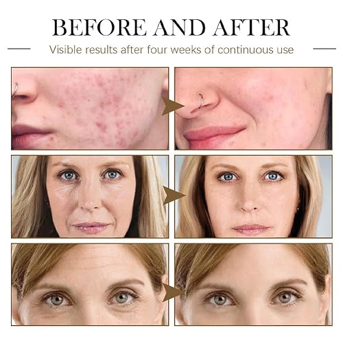 Miniatura 4 de Black Seed Oil for Face, Rosehip Oil Face Serum,miracle Facial Moisturizer Organic Natural Face Oil Anti-Aging Serum Natural Skincare