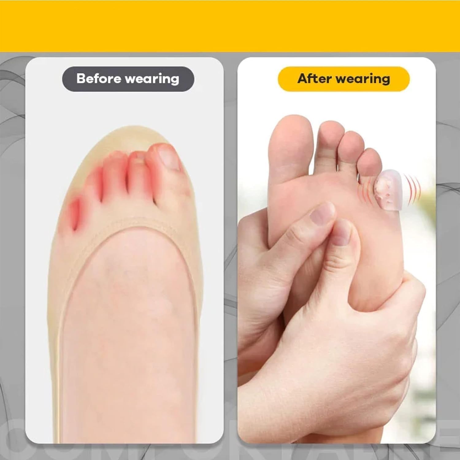 Protezione per dita in silicone anti-attrito, protezioni per dita dei piedi in gel traspirante, protezioni per dita dei piedi in silicone, protezioni per dita dei piedi in gel con orifizio per flusso