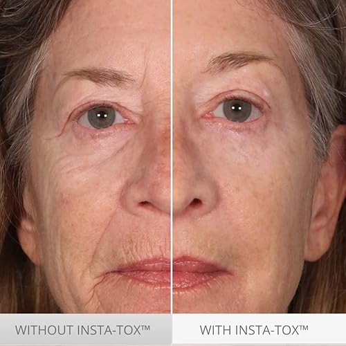 Miniatura 3 de Serious Skincare INSTA-TOX - Suero suavizante instantáneo de arrugas TRIO, mejora la apariencia de líneas finas y arrugas, aprieta temporalmente la