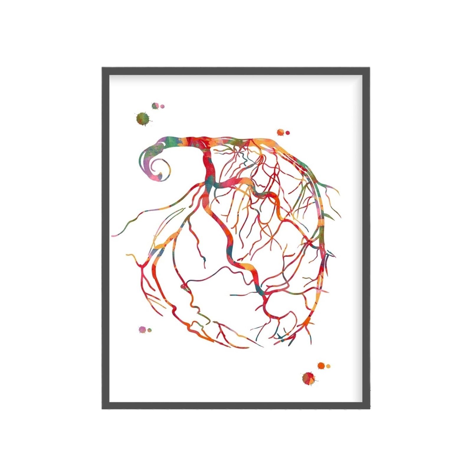 1pc Kardiologia Naczyniowa Sys Plakat Angiogram Anatomia Angiologia Chirurgia Medyczna Obraz Na Płótnie Wall Art Clinic Home Decor(23,40x60cm Unframed)