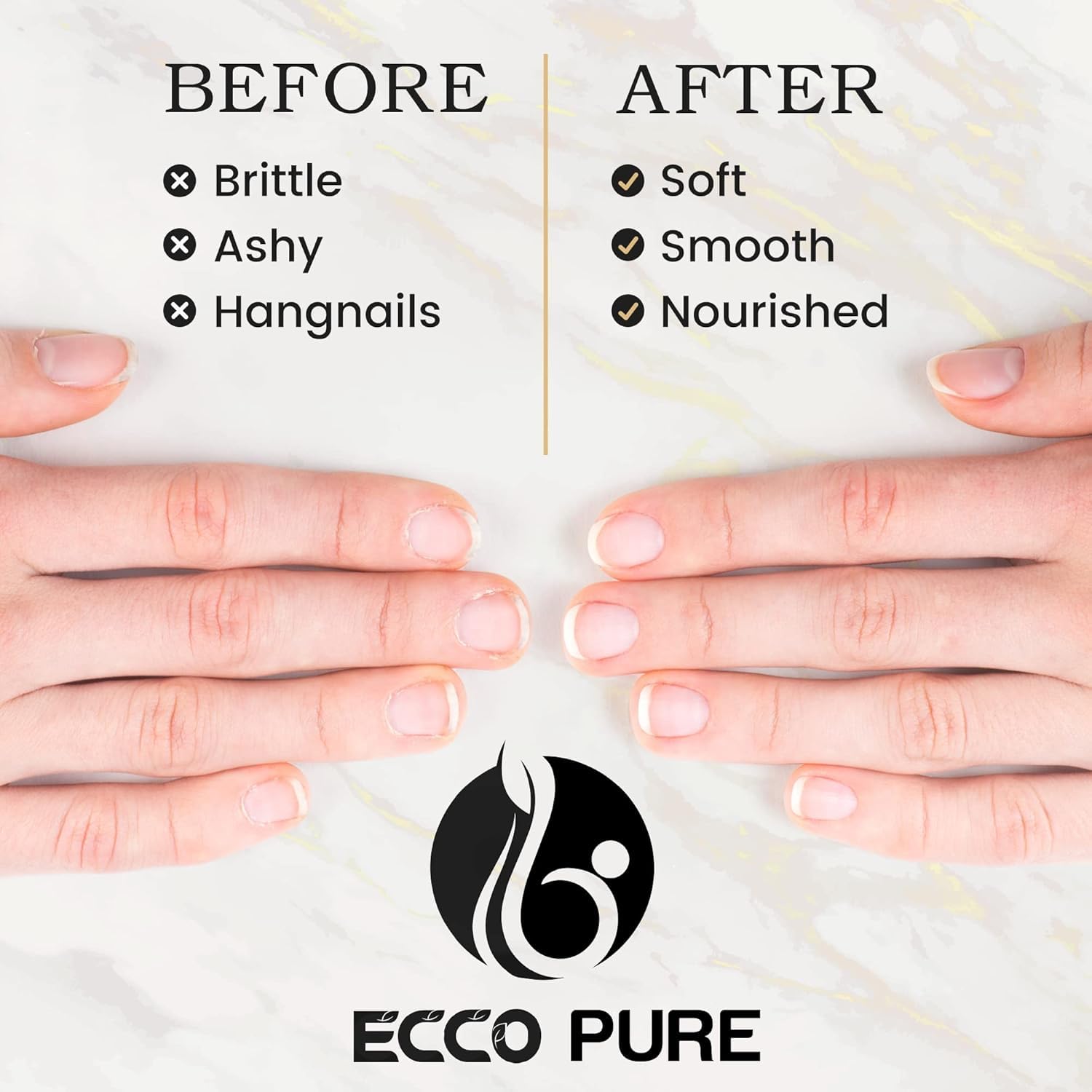 Cuticle Oil Foot Care – Nourishes & Protects Nails and Cuticles – Supports Healthy Toenails, Strength & Appearance – Essential Daily Treatment