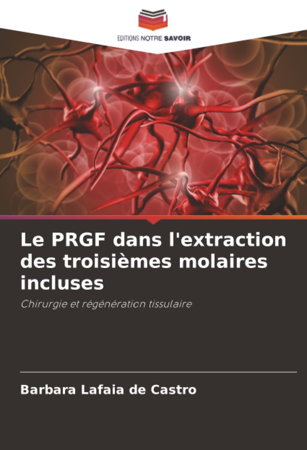 Le PRGF dans l'extraction des troisièmes molaires incluses: Chirurgie et régénération tissulaire