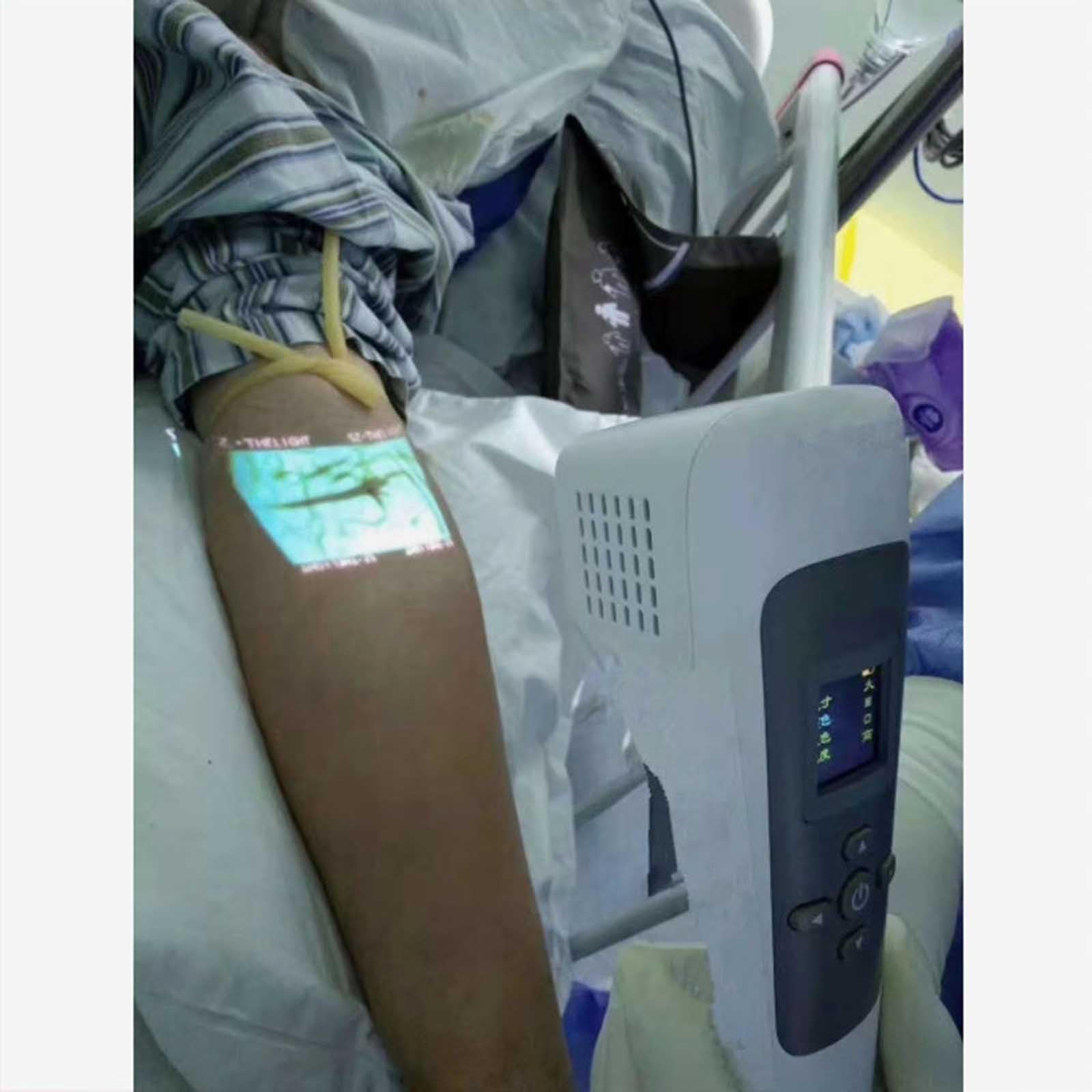 Amazon.co.jp: Infrared Vein Finder Viewer Portable Vein Detector