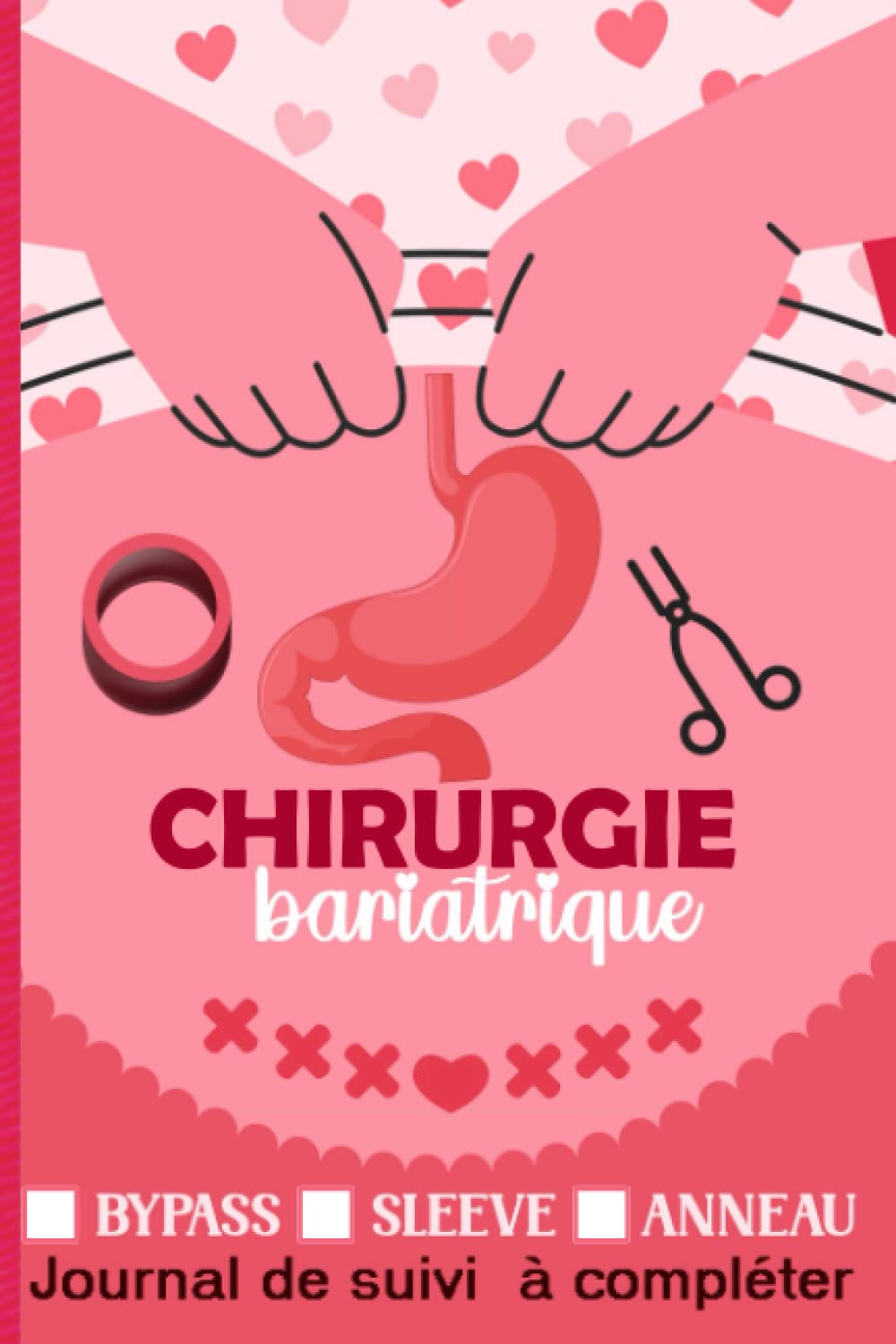 Chirurgie Bariatrique Bypass Anneau Sleeve Journal De Suivi Pre Et