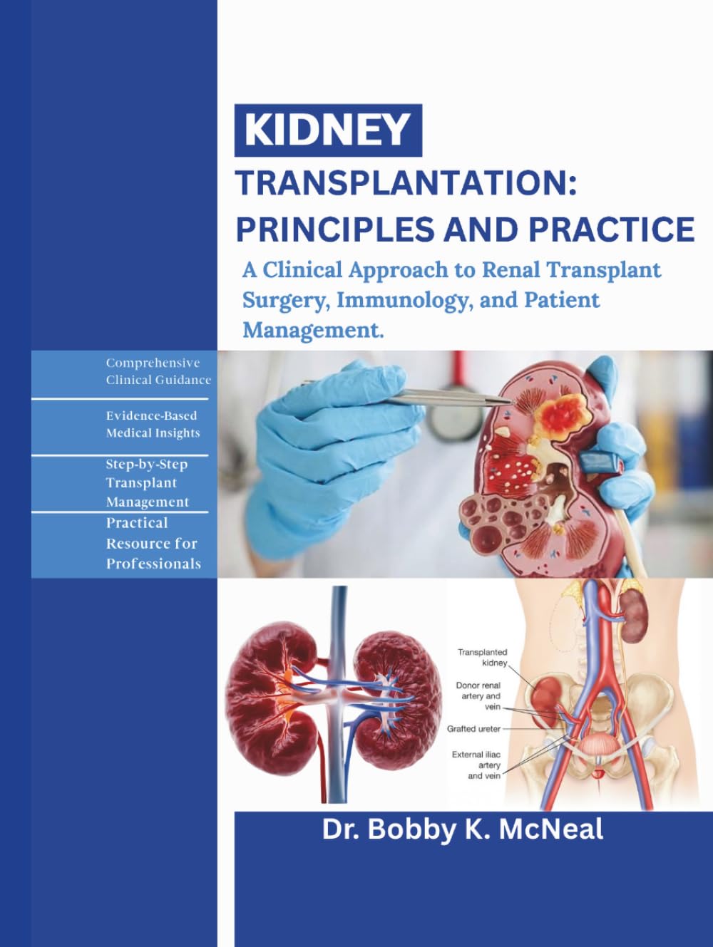 Kidney Transplantation: Principles and Practice: A Clinical Approach to Renal Transplant Surgery, Immunology, and Patient Management.