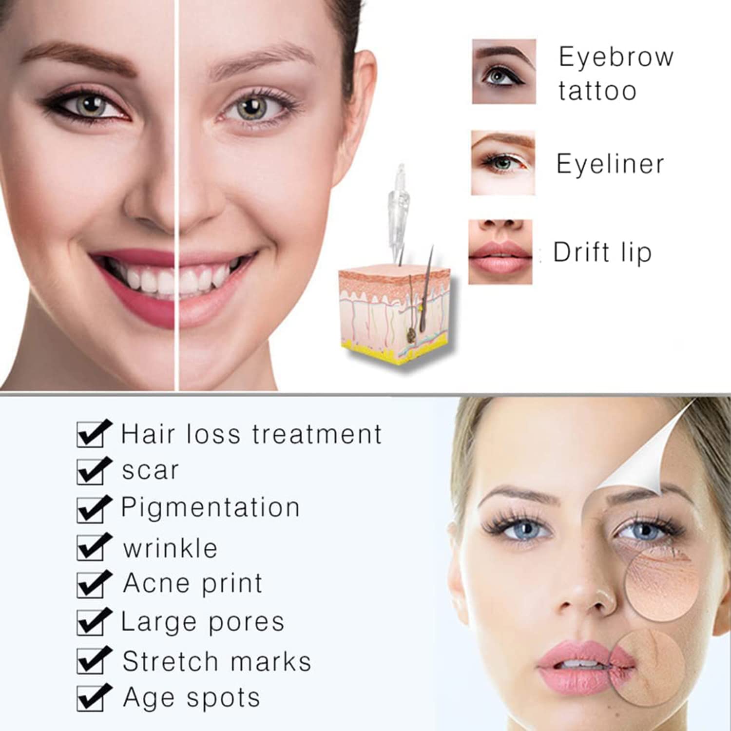 10 Pcs 36 Pin Agujas Dermapen,Dermapen Profesional, Micro Agujas de Reemplazo Sin dolor puntas cartucho Ranura Roscada para Antienvejecimiento Arrugas Rejuvenecimiento de la piel