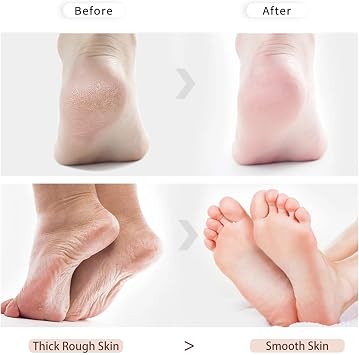 4 PCS Double-Sided Pumice Stone for Feet, Foot Scrubber, Purple