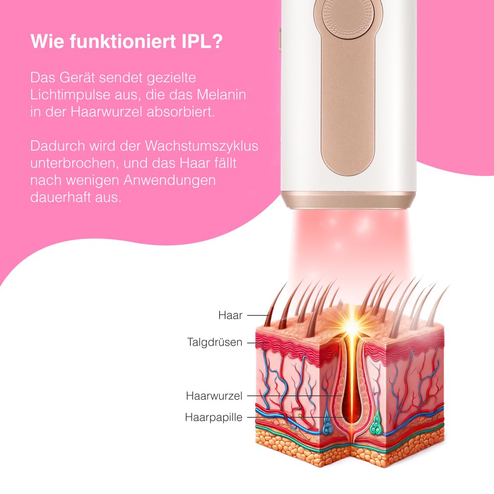 KU2 IPL Supersilk Haarentfernungsgerät für Damen & Herren schmerzfreie Laser Alternative Gesicht Körper dauerhafte Haarreduktion