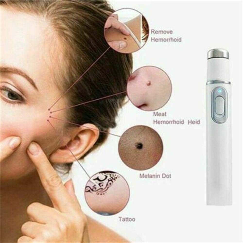Penna Laser per Terapia a Luce Blu per vene varicose, Antirughe e Acne