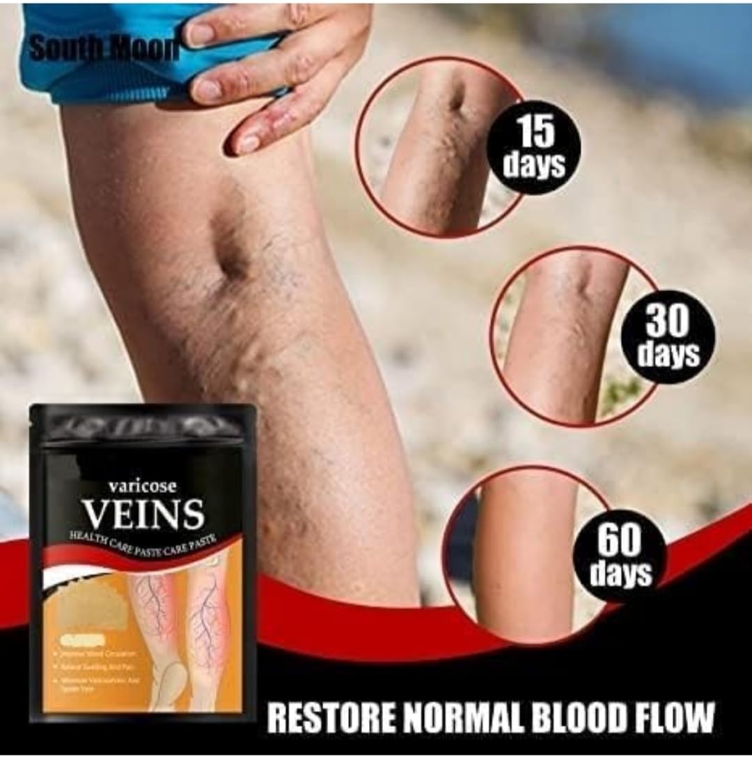 SEINON'S Varicose Veins Patches Dredge Vein Smoothing Varicose Veins Reduce Swelling Relieve Pain Instant Relief From Muscular Pain Improve Blood Circulation Skin Friendly 2