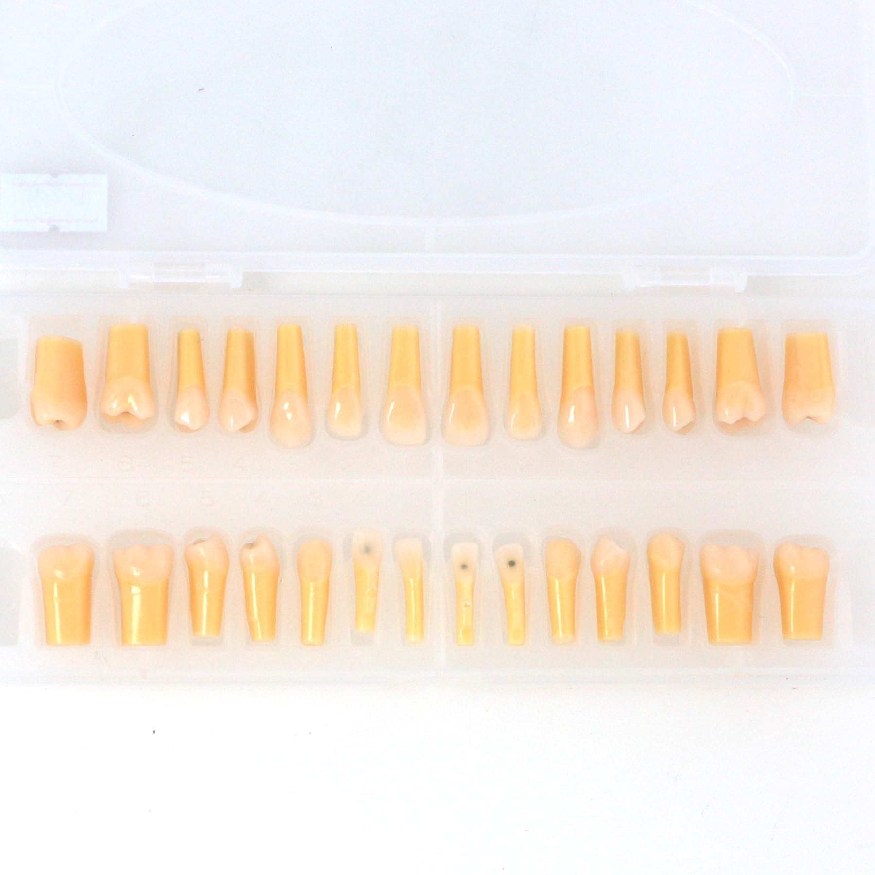 28 Pcs Dental Typodont Teeth Model with Caries Spots Fit for Kilgore Nissin 200 with Box