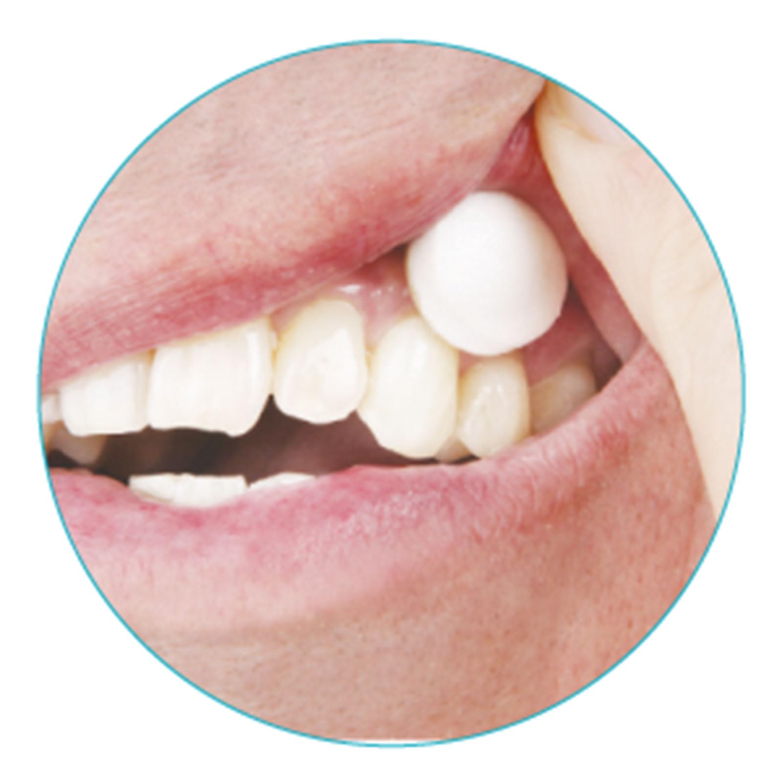 XyliMelts Menta suave 120 unidades [Paquete ahorro] – Tabletas adhesivas contra la sequedad de boca nocturna – hidratar la boca durante el sueño 4-8 horas – sabor a menta discreto – contra la boca