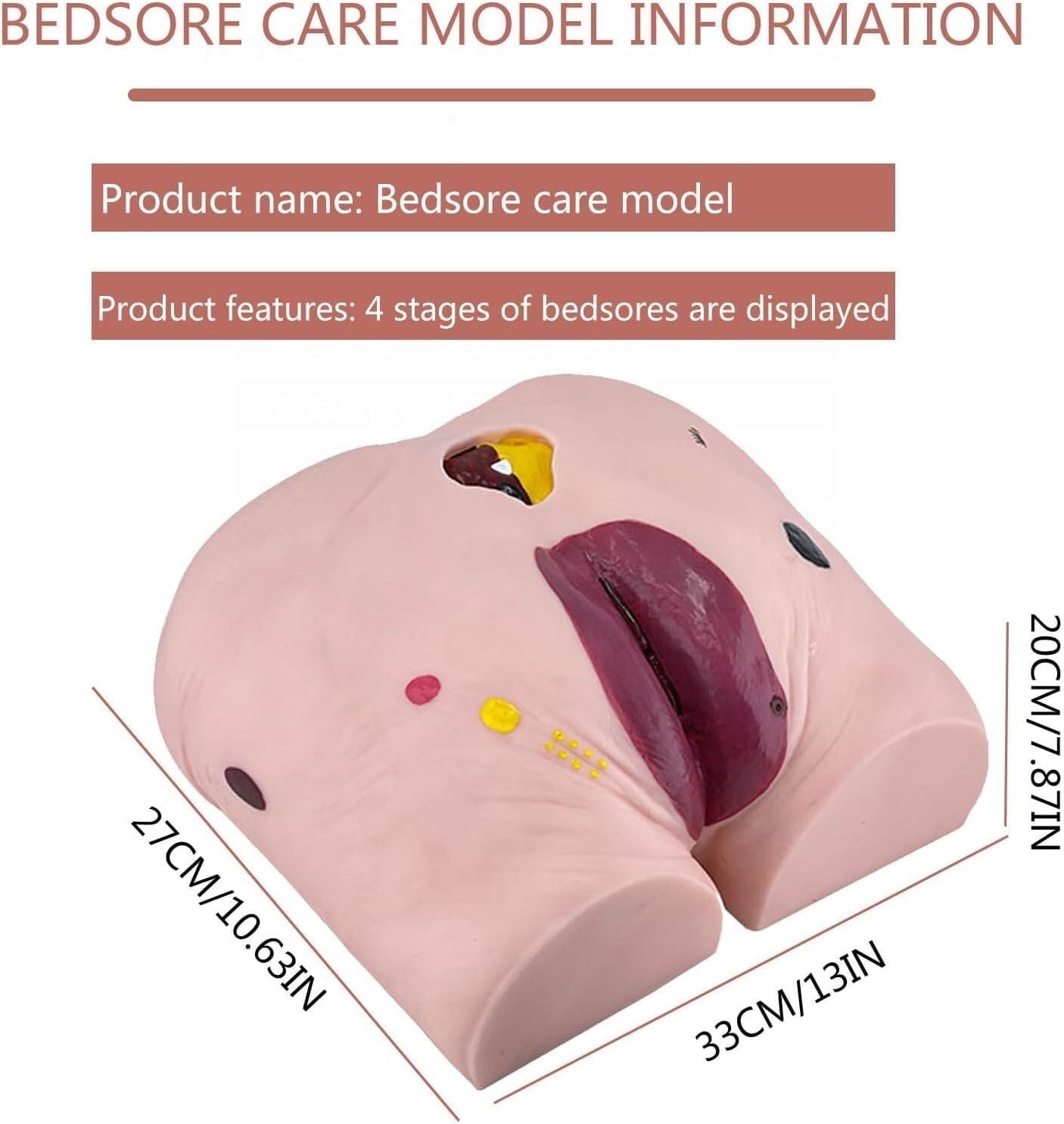 HEQIM Bedsore Ulcer Care Model 4 Stages, Bedsore Care Model, Bedsore Wound Model, Practice Cleaning Basic Nursing Techniques Practical Science Classroom Learning Display