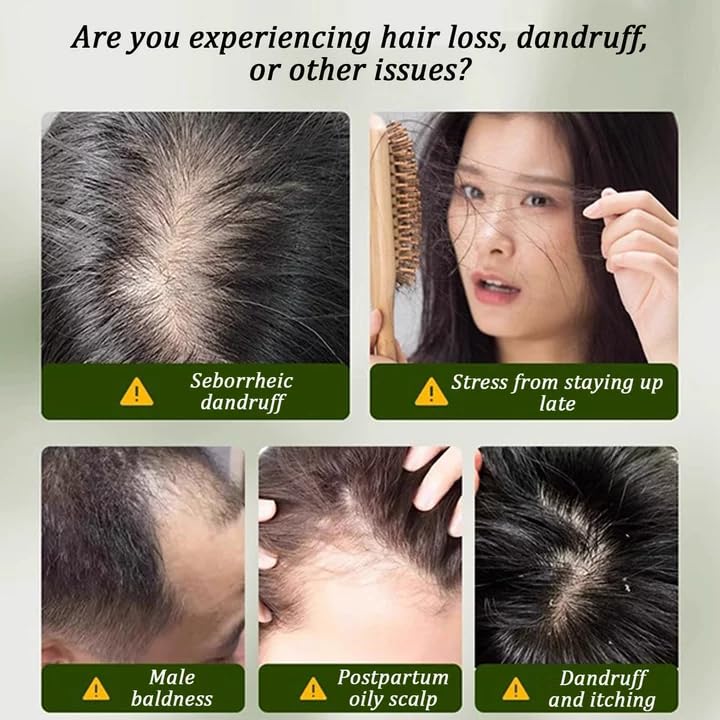 Miniatura 5 de Nature Triangle - Barra de champú, barra de champú Usman Grass, Nature Seven Green Soap Champús, calmante y fortalece el cabello para mujeres y