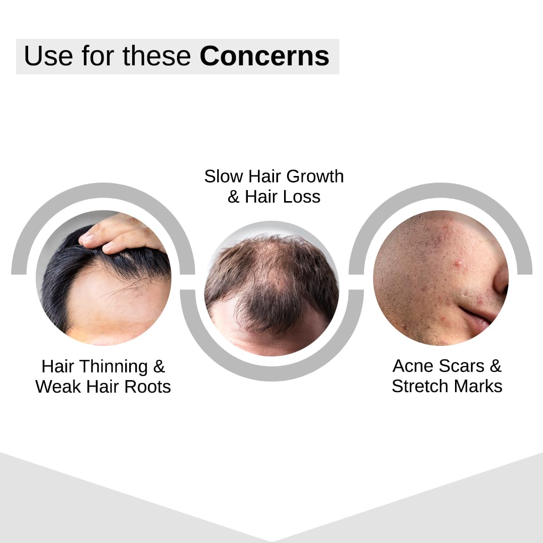 Bare Anatomy Derma Roller pour la pousse des cheveux | 0,25 mm avec 540 micro-aiguilles en titane | Stimule les follicules pileux et améliore la circulation du cuir chevelu