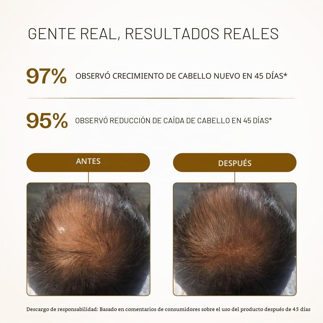 Bare Anatomy Advanced suero para el crecimiento del cabello Roll-On | 3% redensyl + 4% anagain + 2% Baicapil + 5% romero, agua de arroz, biotina y palma enana americana | 25 ml