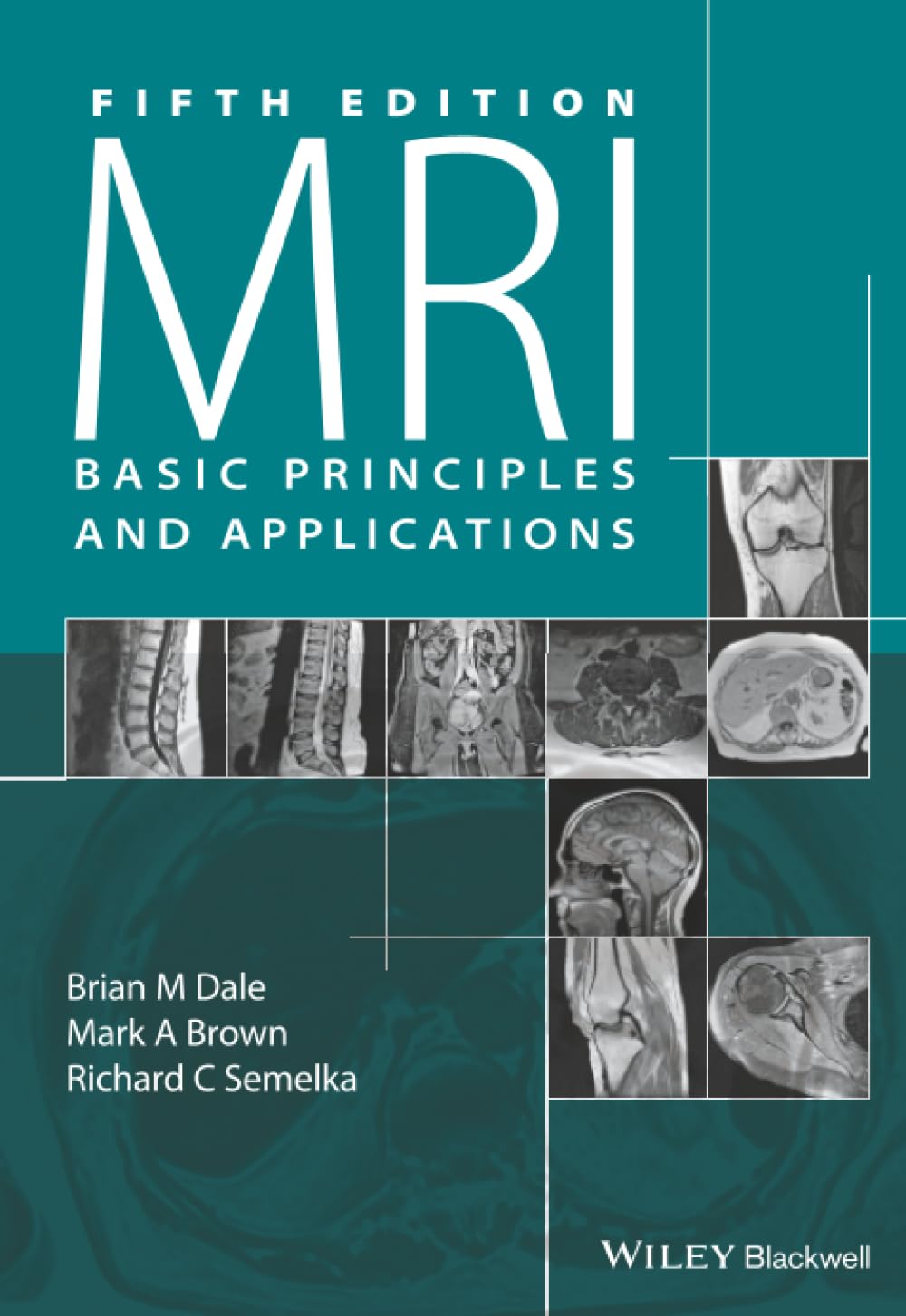 MRI: Basic Principles and Applications, 5th Edition