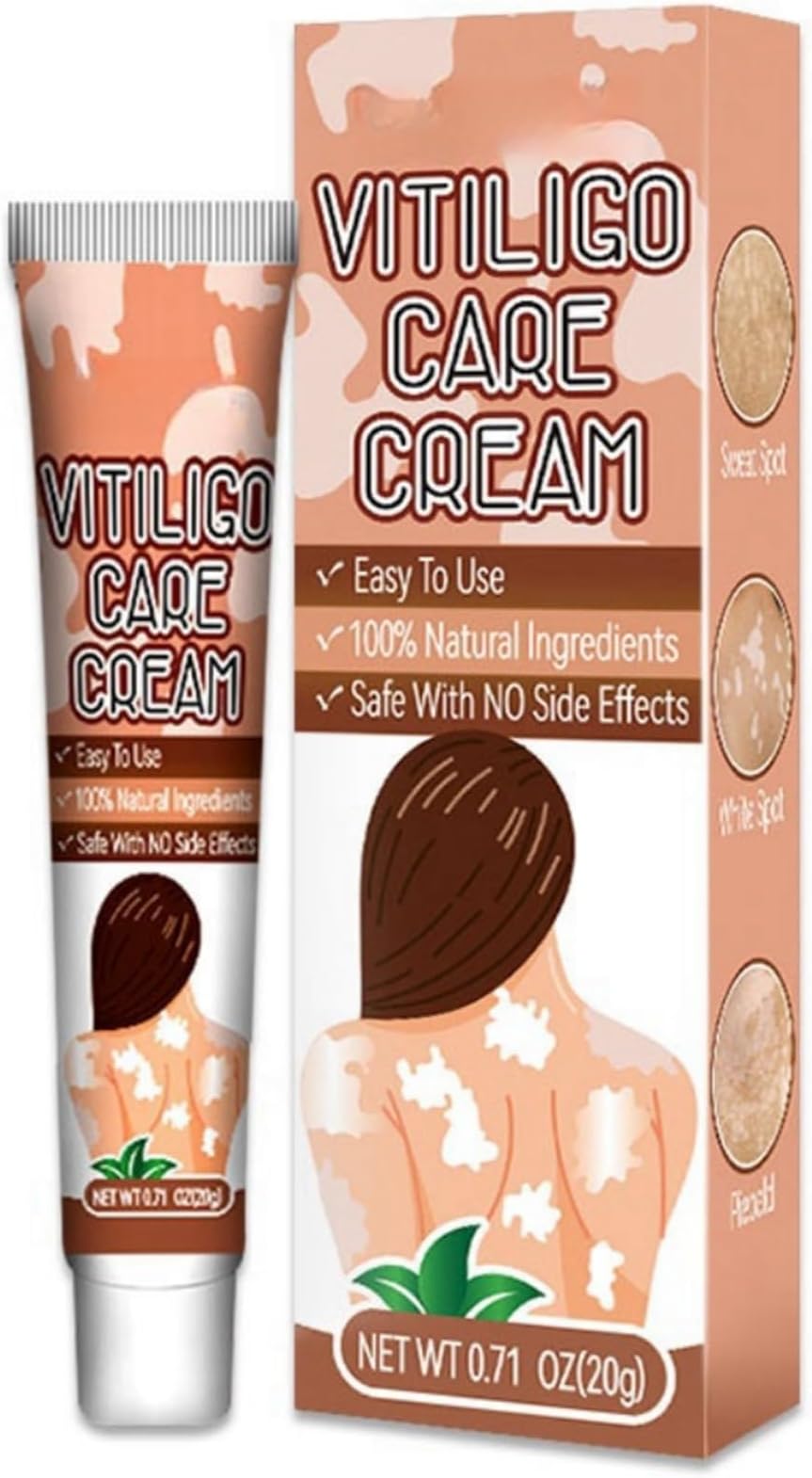 Vitiligo Care Cream 20g, Vitiligo-Specific Formula Skin-Pigmentation Enhancement, Nourishes and Moisturizes, Sun Protection, Soothes Itchy and Irritated Skin, Suitable for Various Body Areas