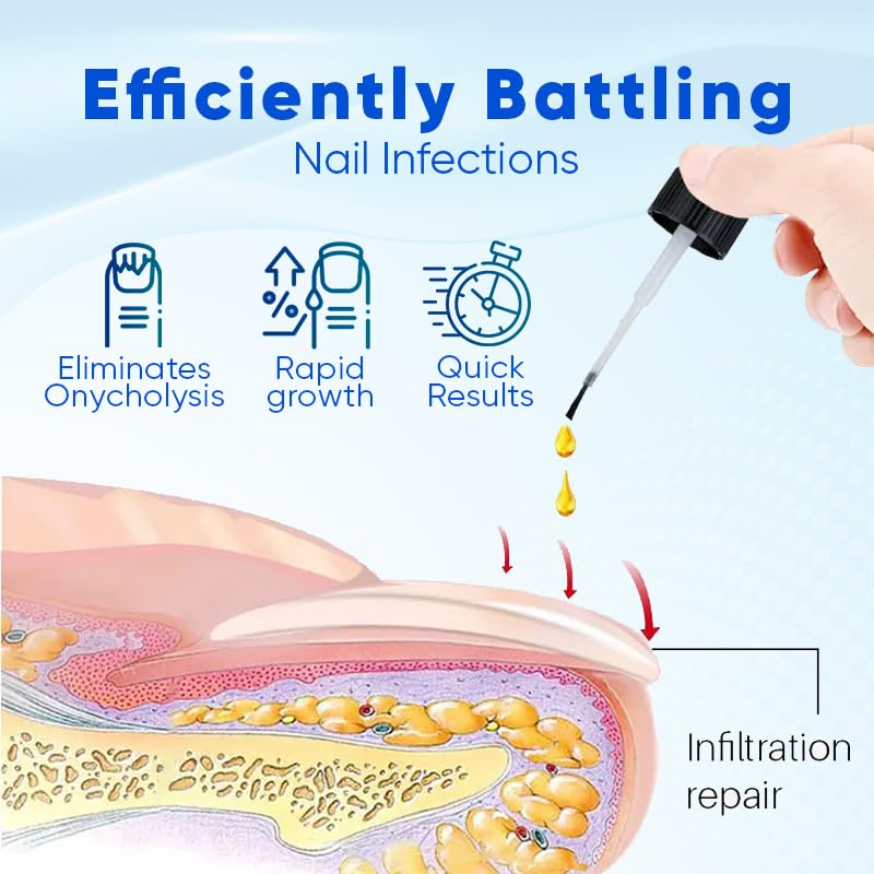 OnyxoGuard Nail Growth and Repair Serum, Advanced Nail Growth Serum, Nail Growth and Strengthener - Revitalize And Strengthen Your Nails 0.5 fl.oz (1 Bottle)