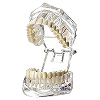 Vista 1 de Modelos de Implantes Dentales Restauración Typodont Dientes Modelo Demostración Oral Patología Puente Enseñar Estudio Color Claro M2001