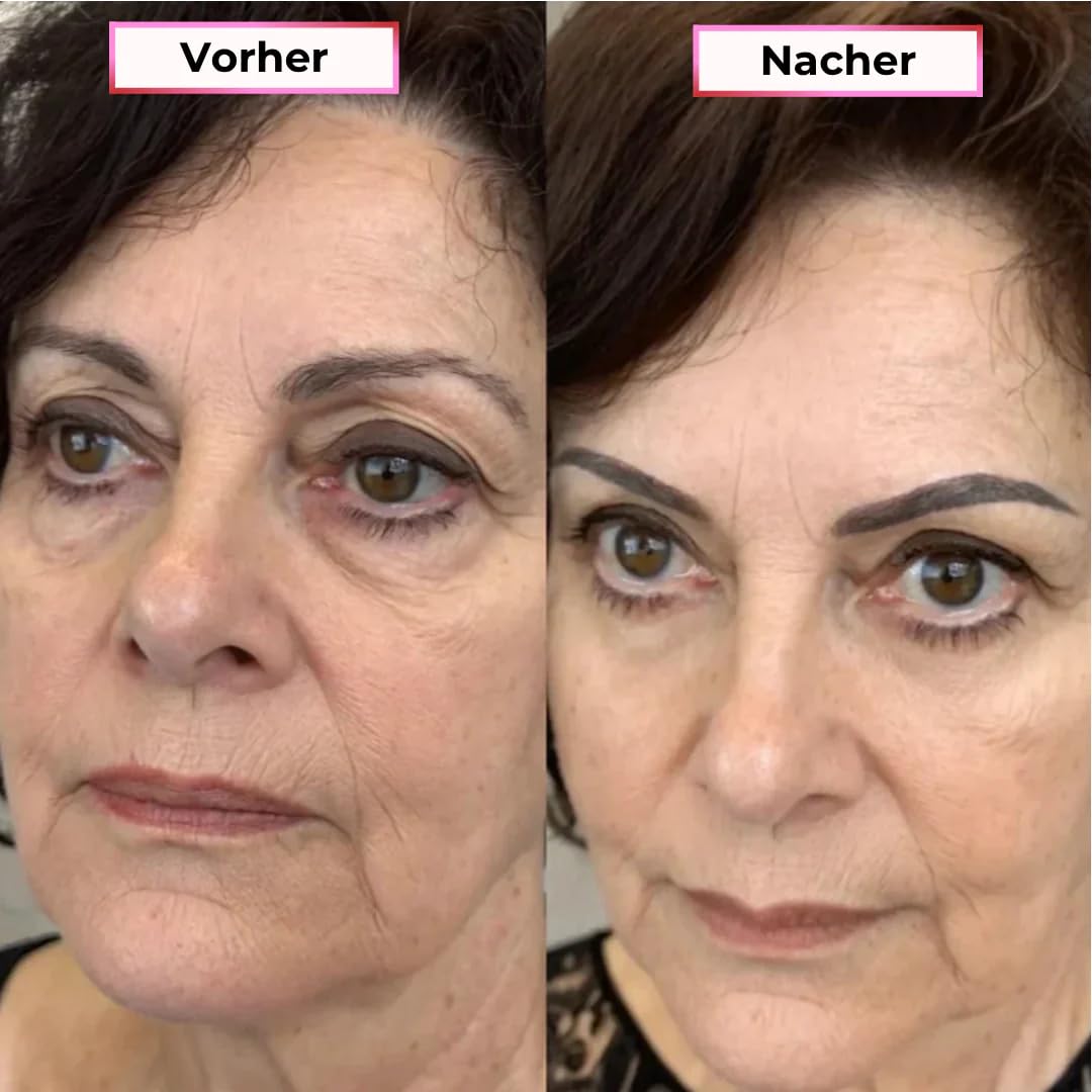 GlowEyes Pro - 2-in-1 Rotlichttherapie + EMS zur Beseitigung von Augenringen Augenmassagegerät mit Rotlichttherapie Reduziert Schwellungen und Falten um die Augen