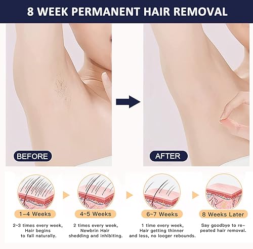 Miniatura 5 de IMENE Depilación IPL, dispositivo de depilación láser para el hogar para hombres y mujeres, removedor permanente sin dolor con 500,000 destellos y 5