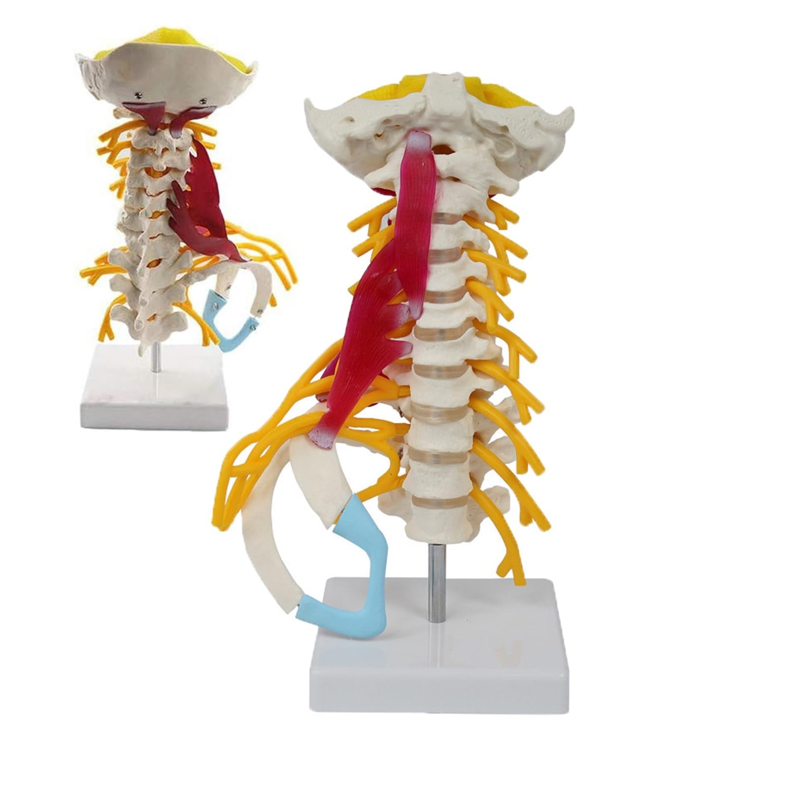 Plaque vertébrale et occipitale sur modèle cervical 1:1