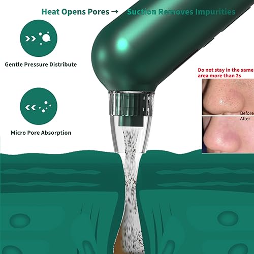 Miniatura 5 de Aspiradora de poros para eliminar puntos negros, 5 niveles de succión y 6 accesorios, aspiradora de poros con calefacción (98.6-107.6 F), pantalla