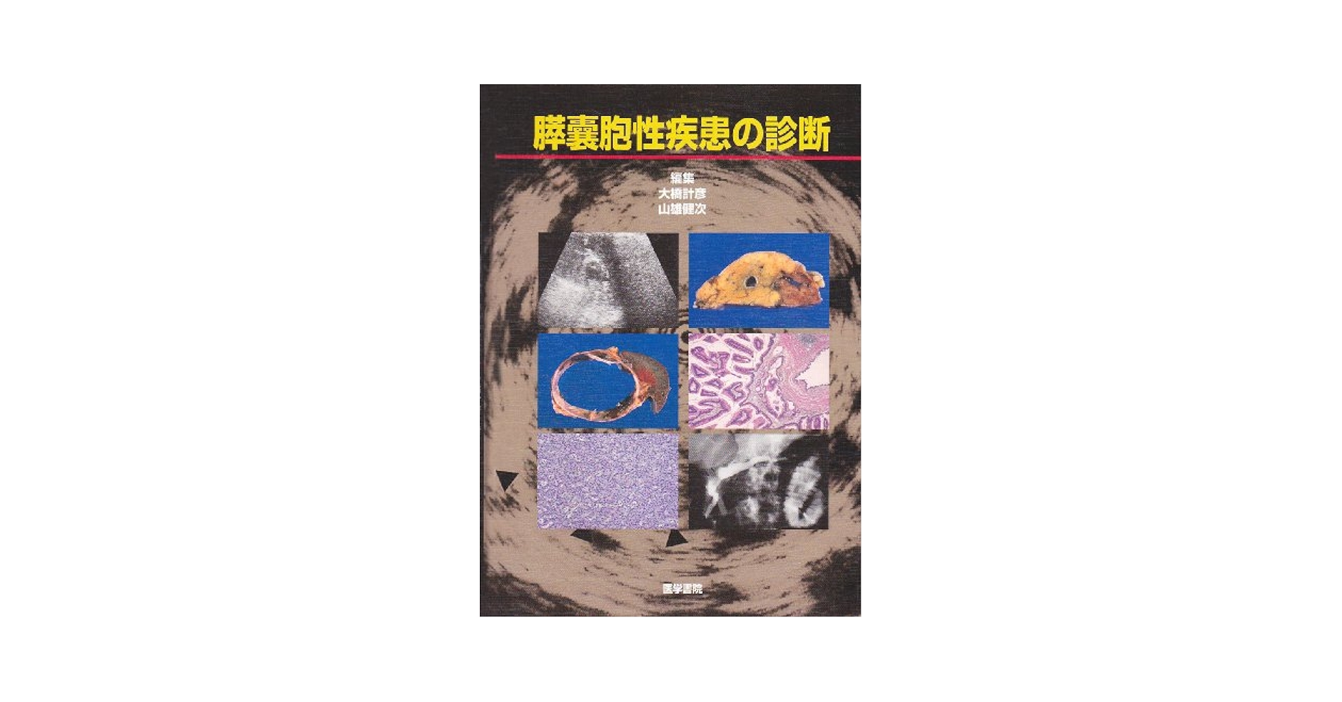 膵嚢胞性疾患の診断 [単行本] 計彦，大橋; 健次，山雄 膵嚢胞性疾患の診断 |本 | 通販 | Amazon