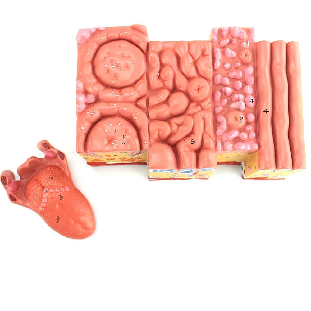 sjdoPulse Tongue Tissue Enlargement Model,Medical Teaching Model-Detailed Display of The Anatomy of The Human Tongue