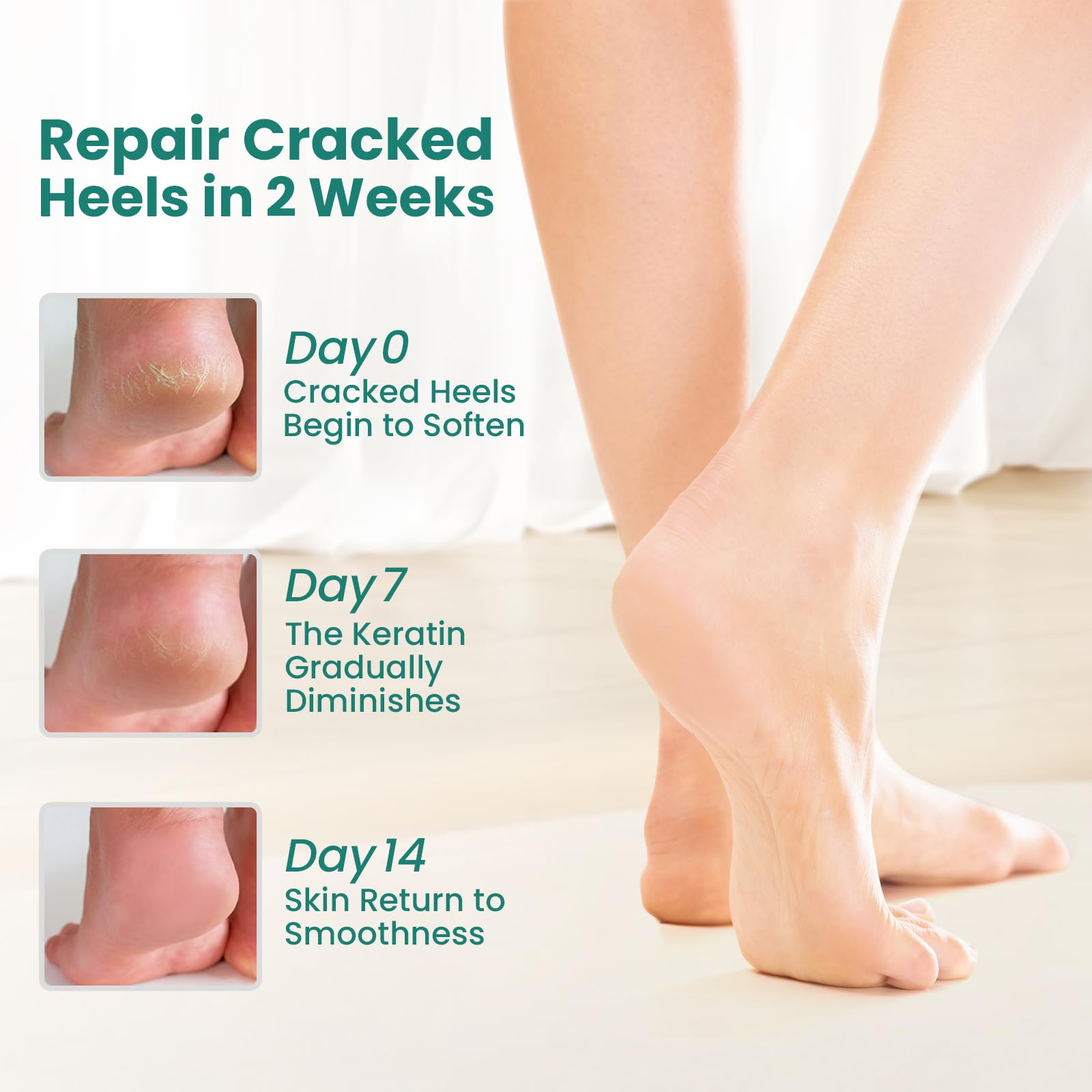 Welnove Lot de 2 paires de chaussettes hydratantes à talon Extrait d'aloe vera Doublure en gel pour pieds secs Traitement de réparation du talon fissuré