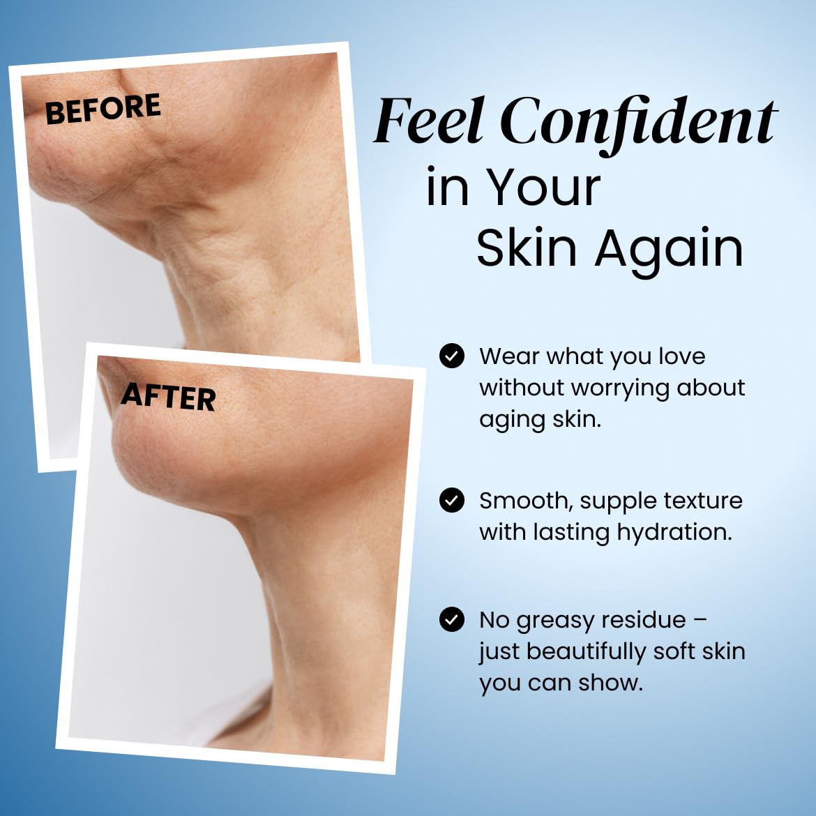 Advanced Crepe Fix- Firming & Smoothing Cream for Crepey, Aging Skin- Hydrates, Lifts & Restores Skin on Arms, Legs & Body- Fast Absorbing, Non-Greasy Formula - 120ml - Image 4