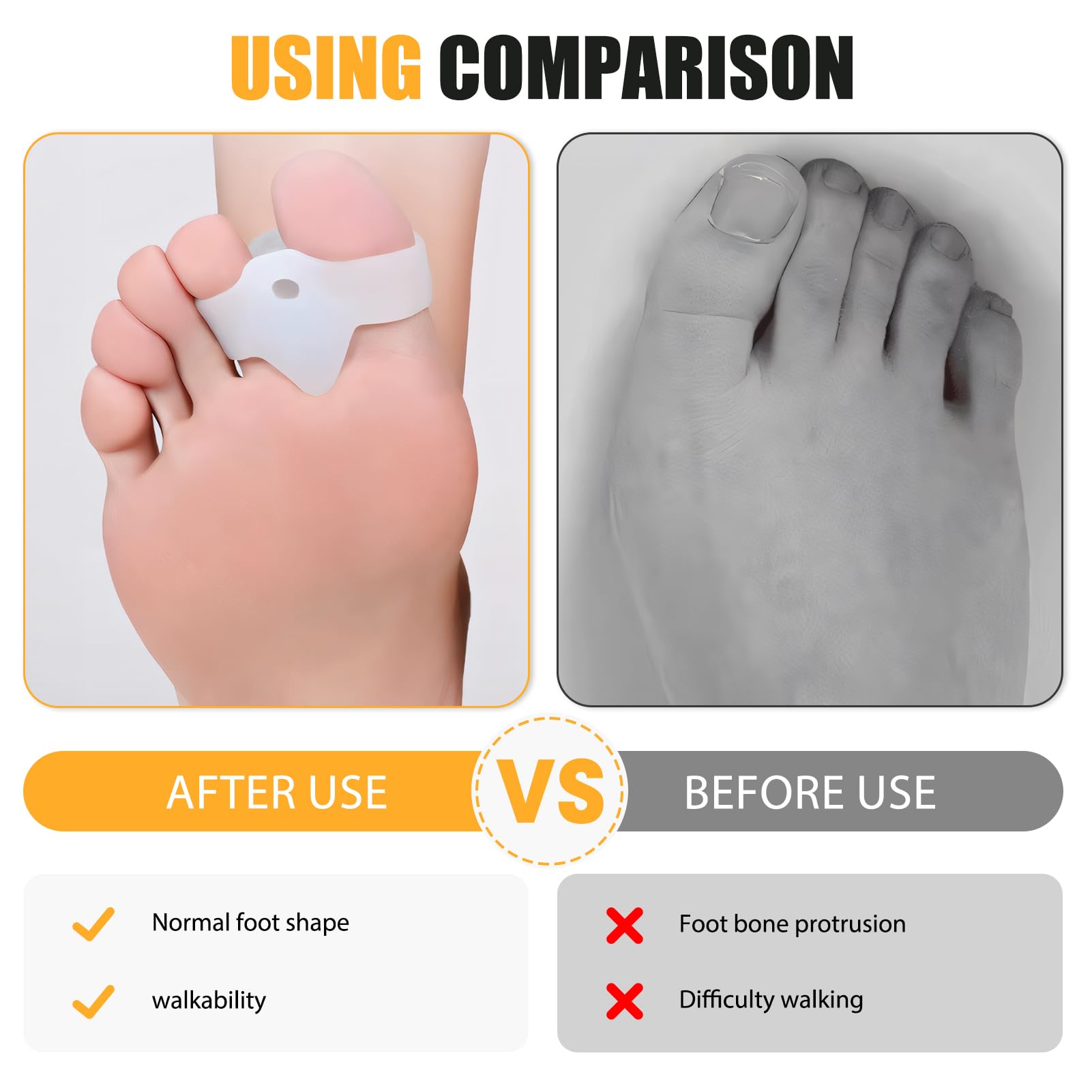 Pack de 12 Separador Dedos pie, para Hallux Valgus y Juanetes, Separadores Flexibles de Dedo del Pie y Alineación de Dedo del Pie para Comodidad Diaria (Blanco)