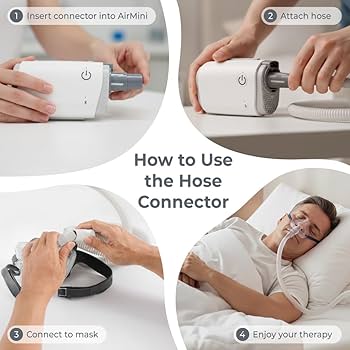 Amazon.co.jp: ZephAir ユニバーサルCPAPホースコネクター AirMini対応