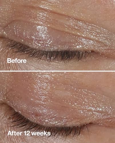 Clinique Smart Clinical Repair Wrinkle Correcting