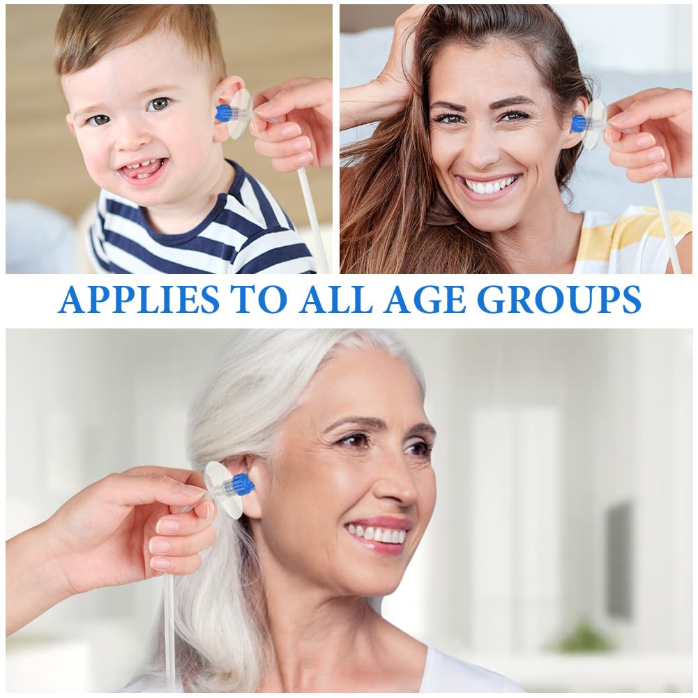 Kit de Retrait de Cérumen, Kit de Nettoyage Manuel pour Lave-oreille, Nettoyant auriculaire Safe Effective pour adultes&enfants