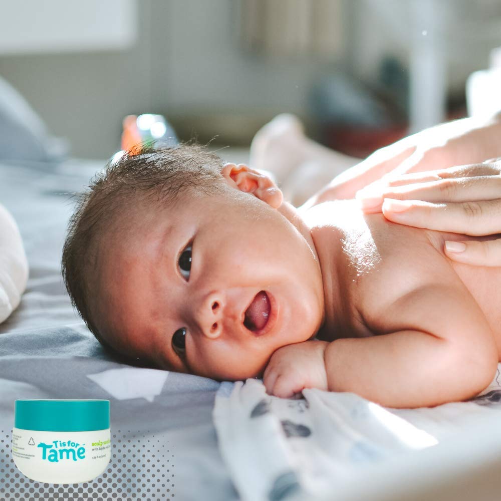 T is for Tame Cradle Cap Treatment for Babies, Toddlers & Kids Made