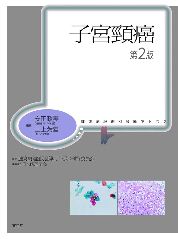 【裁断済】腫瘍病理鑑別診断アトラス 子宮頸癌 第2版 子宮頸癌 第2版 (腫瘍病理鑑別診断アトラス) | 安田政実, 三上