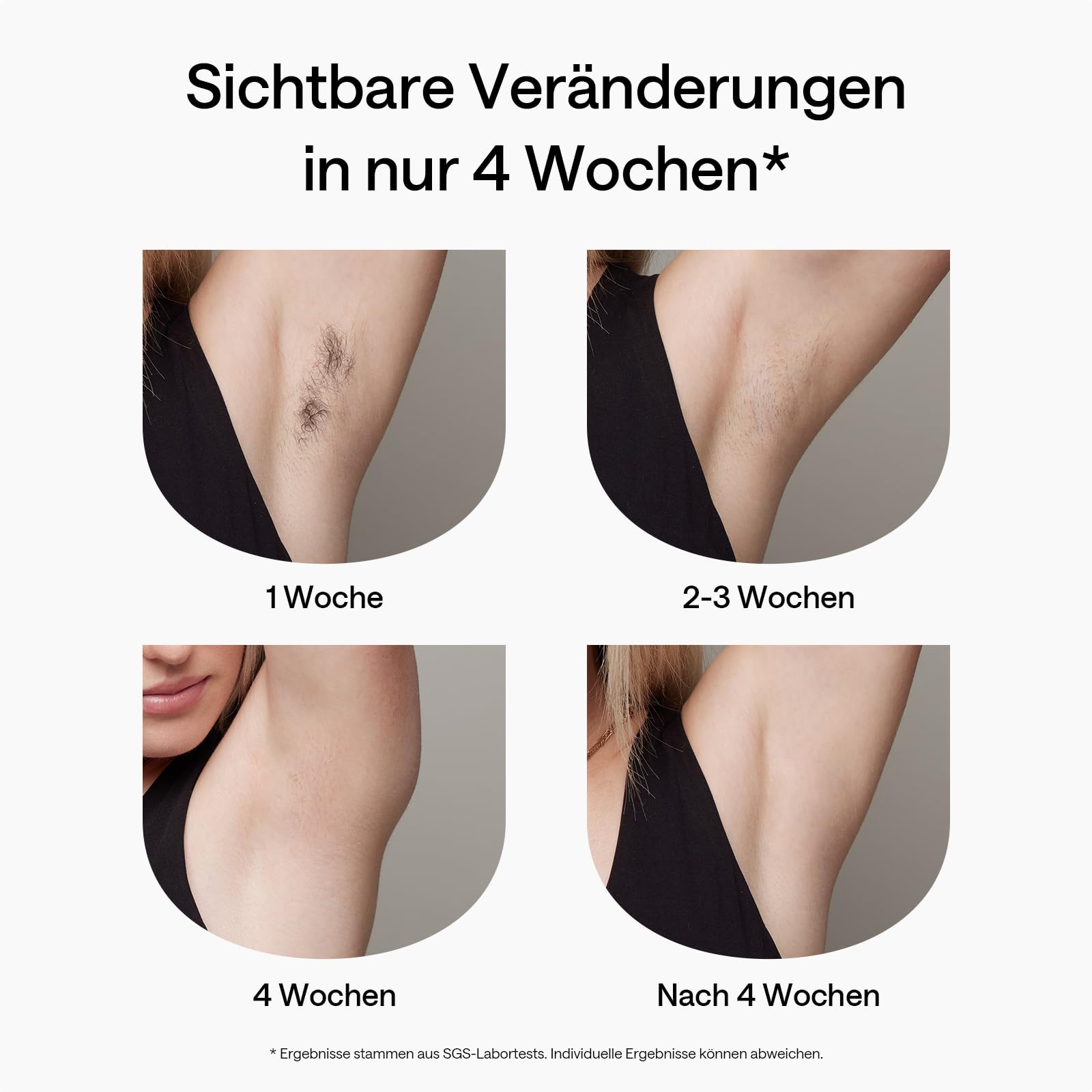 Ulike Air 2 IPL Gerät Haarentfernung mit Eiskühltechnik, schmerzfrei, Laser Alternative für Körper und Gesicht