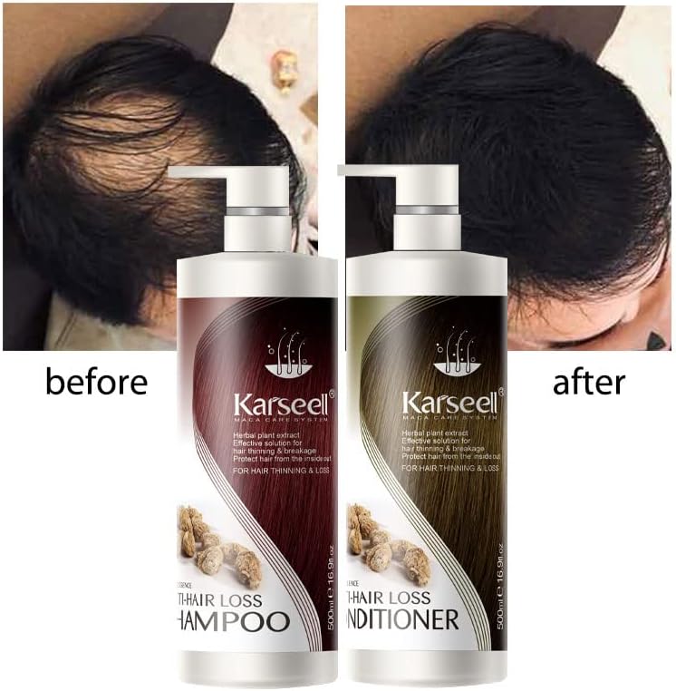 Hair Growth Shampoo & Conditioner Set For Women Best Vegan Shampoo