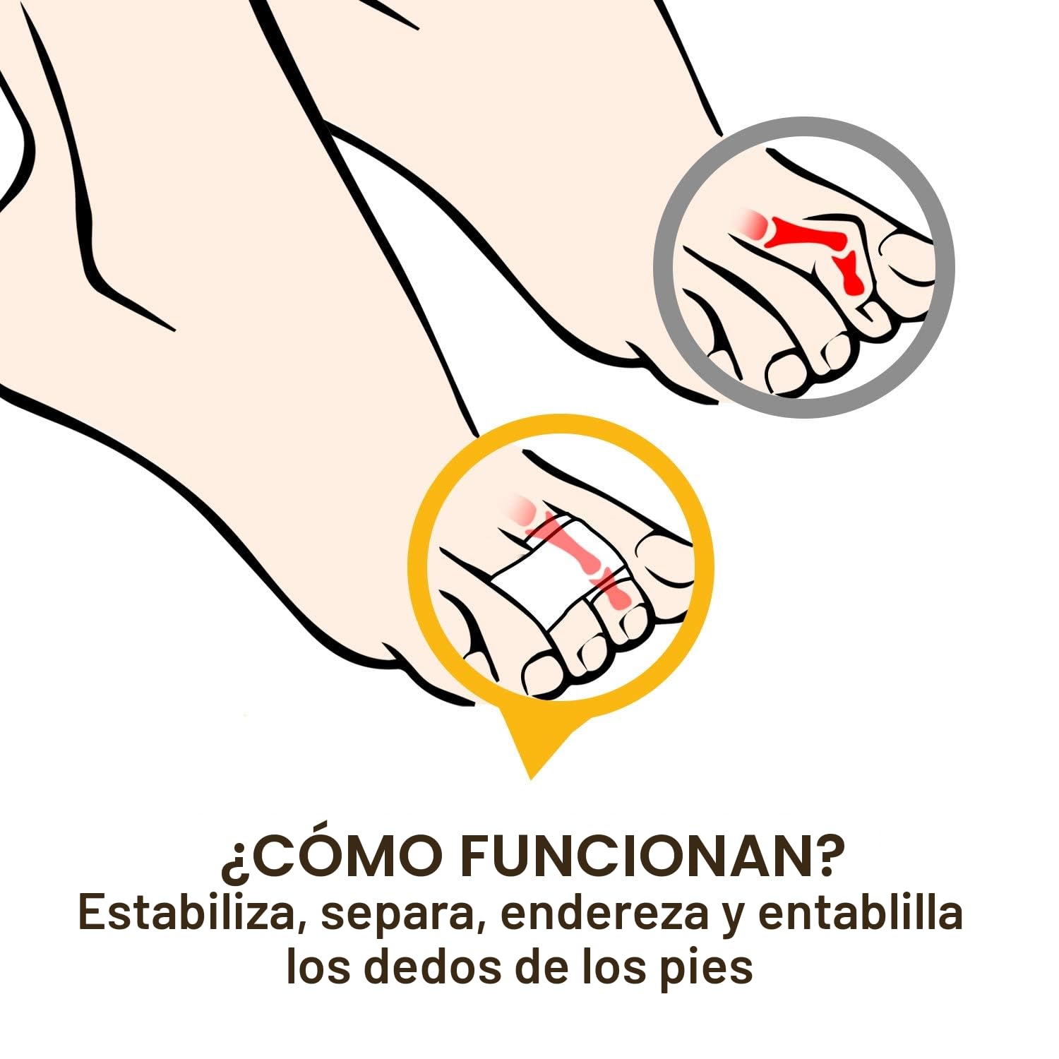 6 Piezas Correctores de Dedos del Pie - Welnove Férulas para Dedos en Martillo y Juanetes, Separadores para Alinear Dedos Torcidos o Superpuestos