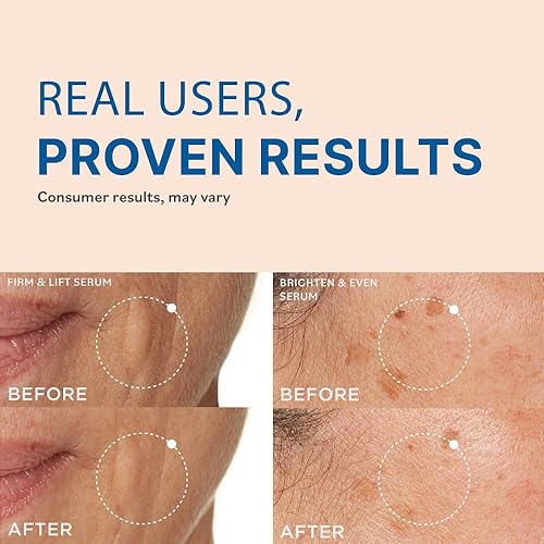 Miniatura 3 de goPure Power Serum Trio Set - Radiant Vitamin C Serum, Hydrating Hyaluronic Acid, Bakuchiol and Retinol for Visibly Brighter, Moisturized, and