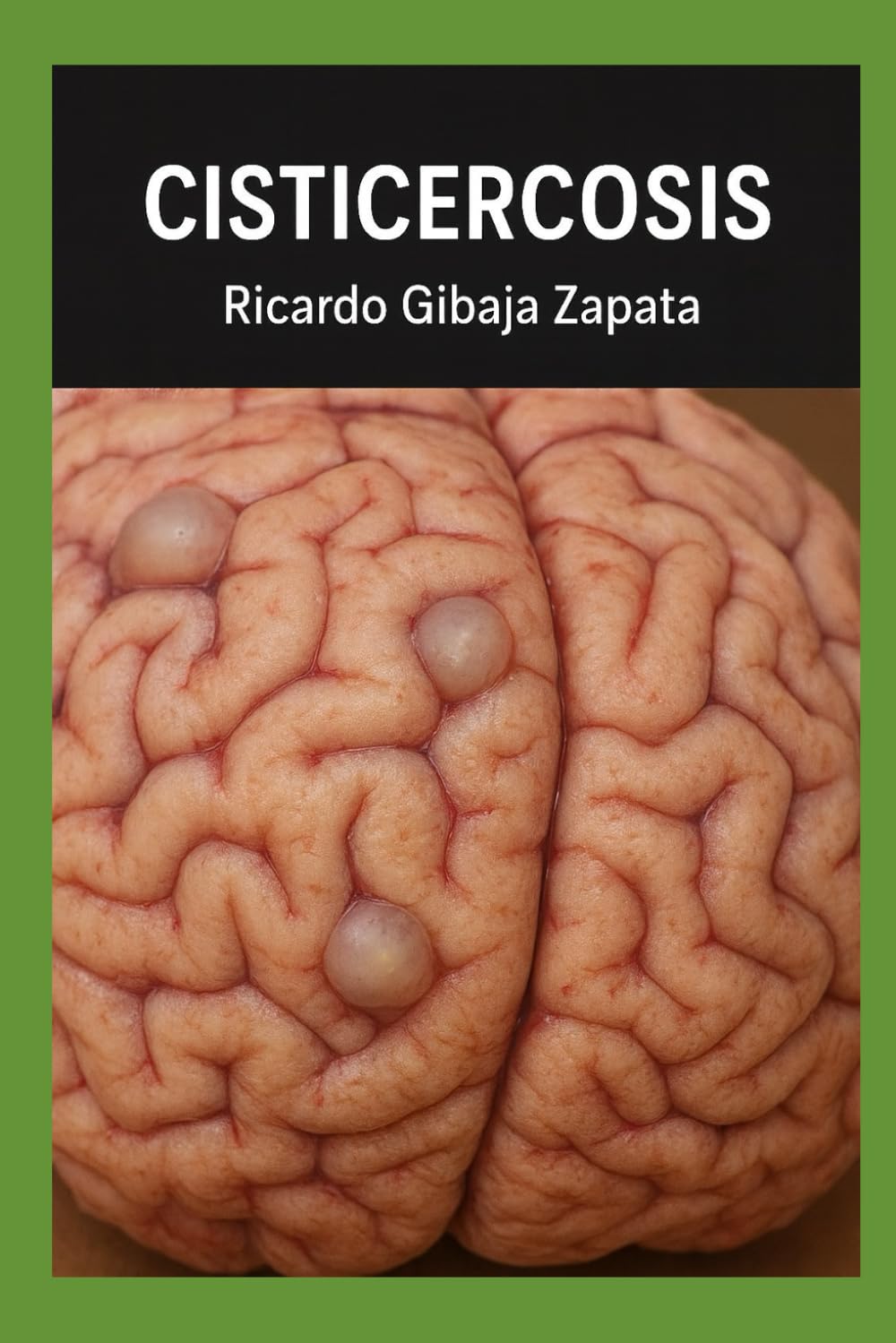 CISTICERCOSIS: TIPOS, ETIOLOGÍA, DIAGNÓSTICO, TRATAMIENTO Y TERAPIAS
