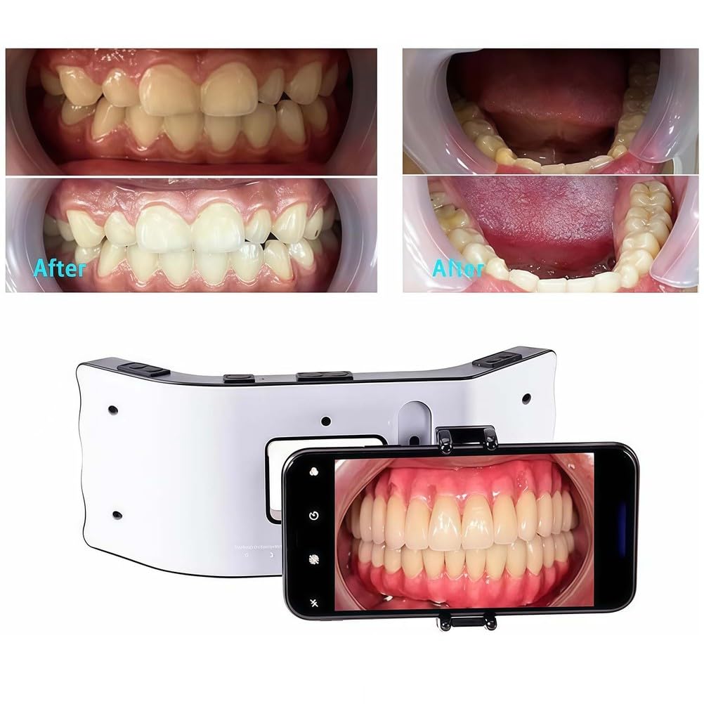 Luz de fotografía dental, luz LED de relleno oral con 20 cuentas de lámpara y diseño de iluminación envolvente 3D, soporte móvil para salón en casa y fotografía macro