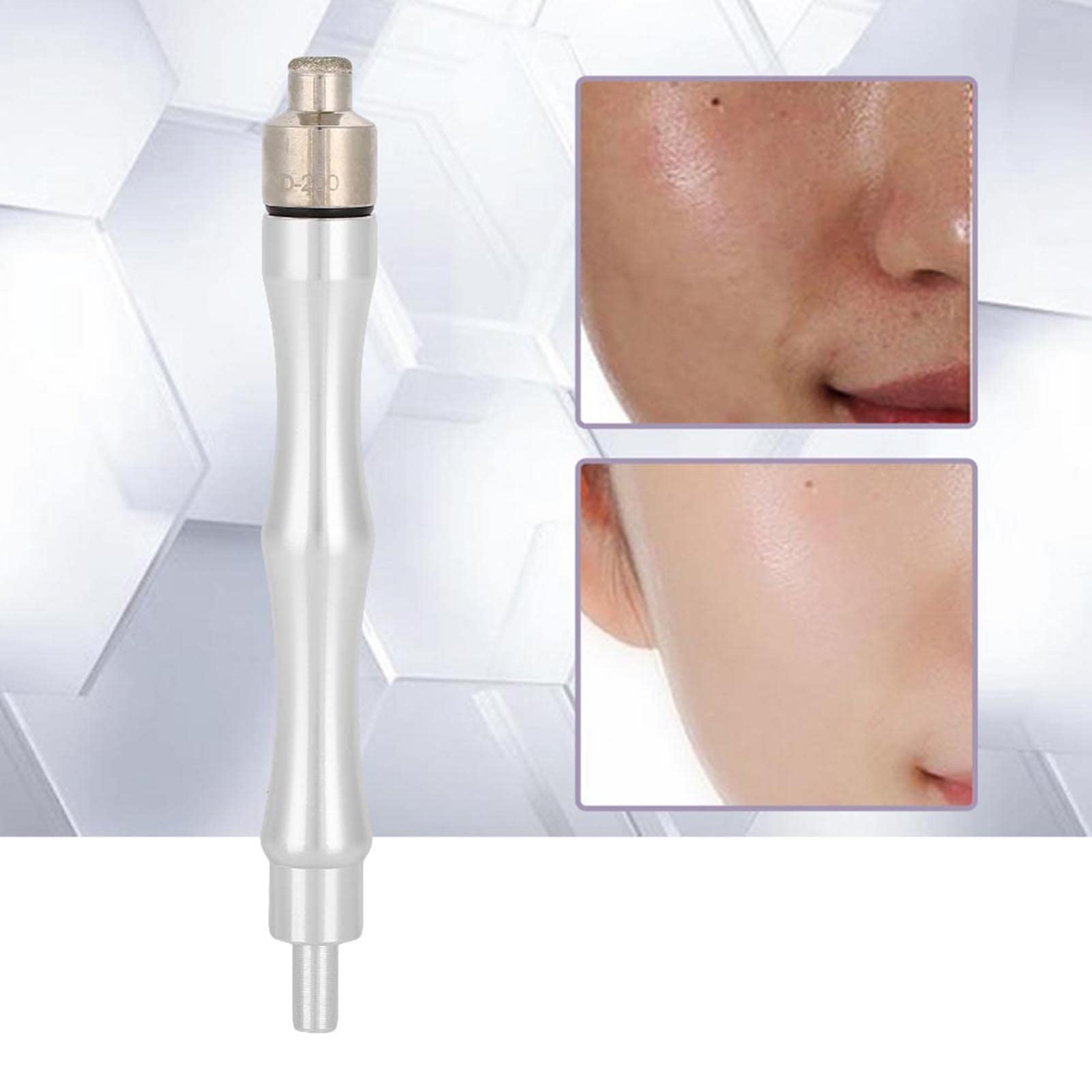 Cabezales de microdermoabrasión de diamante, puntas de repuesto de microdermoabrasión con mango de filtro de acero inoxidable, juego de accesorios de máquina de belleza para cuidado facial